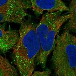 TAS2R10 Polyclonal Antibody