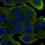 DYX1C1 Polyclonal Antibody