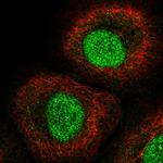 IRF1 Polyclonal Antibody