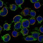 ARHGEF6 Polyclonal Antibody