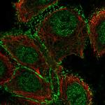 GALNT12 Polyclonal Antibody