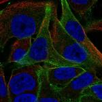 PPFIBP1 Polyclonal Antibody