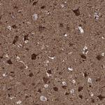 PPFIBP1 Antibody in Immunohistochemistry (Paraffin) (IHC (P))