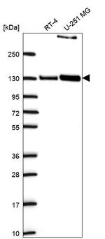 PPFIBP1 Antibody in Western Blot (WB)