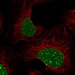 HP1 beta Polyclonal Antibody