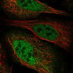 ZBTB8B Polyclonal Antibody