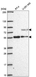 CENPI Antibody in Western Blot (WB)