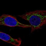 MCCC1 Polyclonal Antibody