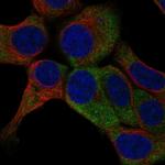 RPS23 Polyclonal Antibody