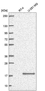 RPS23 Antibody in Western Blot (WB)