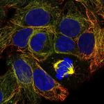 CFAP99 Polyclonal Antibody