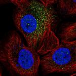 SorCS2 Polyclonal Antibody