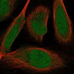 ZMIZ2 Polyclonal Antibody