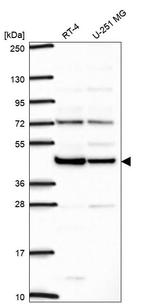 ILF2 Antibody in Western Blot (WB)