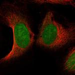 CNTD1 Polyclonal Antibody