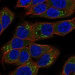 SCYL3 Polyclonal Antibody