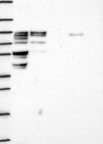 SCYL3 Antibody in Western Blot (WB)
