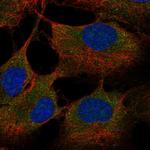 ST6GALNAC6 Polyclonal Antibody