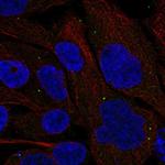 GSDMC Polyclonal Antibody
