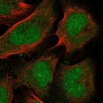 PTF1A Polyclonal Antibody