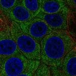 p38 MAPK beta Polyclonal Antibody