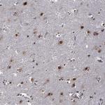 ZNF775 Antibody in Immunohistochemistry (Paraffin) (IHC (P))