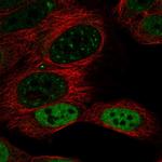 DACH1 Polyclonal Antibody