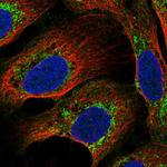 C17orf80 Polyclonal Antibody