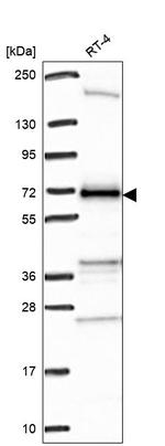 C17orf80 Antibody in Western Blot (WB)