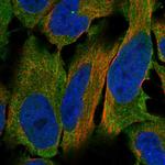 LHR Polyclonal Antibody