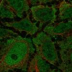 CCKAR Polyclonal Antibody