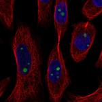 AXIN1 Polyclonal Antibody