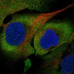 eIF5A Polyclonal Antibody