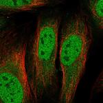 TIP60 Polyclonal Antibody