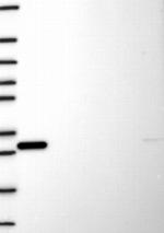 TIP60 Antibody in Western Blot (WB)