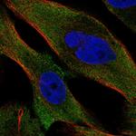 PPP3CC Polyclonal Antibody