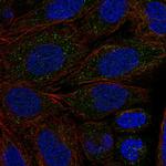 CYP2C18 Antibody in Immunocytochemistry (ICC/IF)