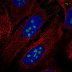 RORA Polyclonal Antibody