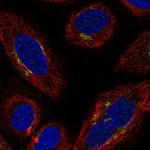 ITFG2 Polyclonal Antibody