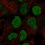 BRD2 Polyclonal Antibody