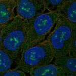 ZNF175 Polyclonal Antibody
