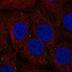 CTNS Polyclonal Antibody