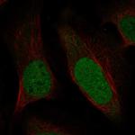 TIAL1 Polyclonal Antibody