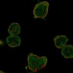 HSFY1 Polyclonal Antibody