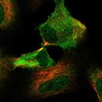 GPX2 Polyclonal Antibody