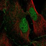 NHSL2 Polyclonal Antibody