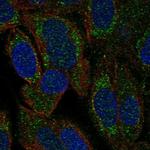 HARS2 Polyclonal Antibody
