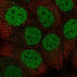 CBX6 Polyclonal Antibody