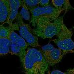 RPLP2 Polyclonal Antibody