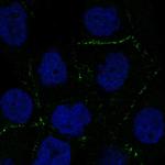 TMEM24 Polyclonal Antibody